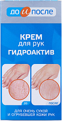  Крем для рук "До и после" Гидроактив для сухой кожи 100мл N1 